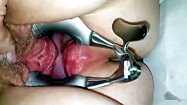 Polish amateur mature, stretching gyno, mature amateur fingering, polish hairy pussy, fingering stretching